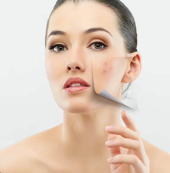 Spot Removal.jpg